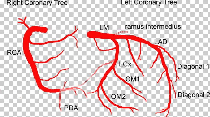 Coronary Circulation Anterior Interventricular Branch Of Left Coronary Artery Anatomy Coronary Arteries PNG, Clipart, Angiography, Area, Artery, Cardiac Catheterization, Cateterisme Free PNG Download