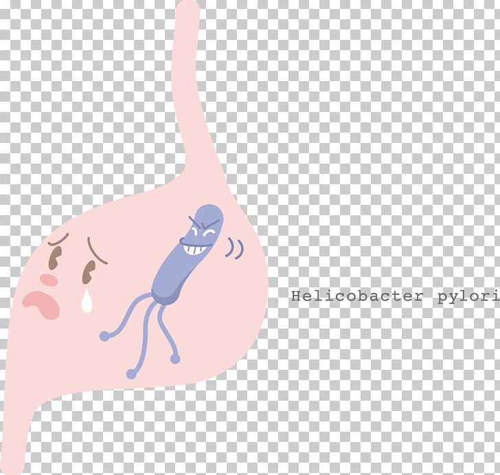 Helicobacter Pylori Stomach Cancer Gastritis Esophagogastroduodenoscopy PNG, Clipart, Arm, Bad Breath, Disease, Duodenum, Endoscopy Free PNG Download