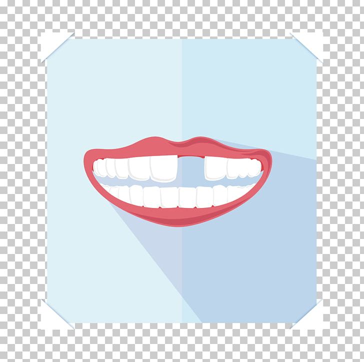 Smile Dentist Human Tooth Crown PNG, Clipart, Angle, Banana, Brand, Bridge, Cadcam Dentistry Free PNG Download