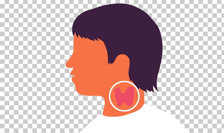 Thyroid Cancer Disease Hashimoto's Encephalopathy Iodine PNG, Clipart,  Free PNG Download