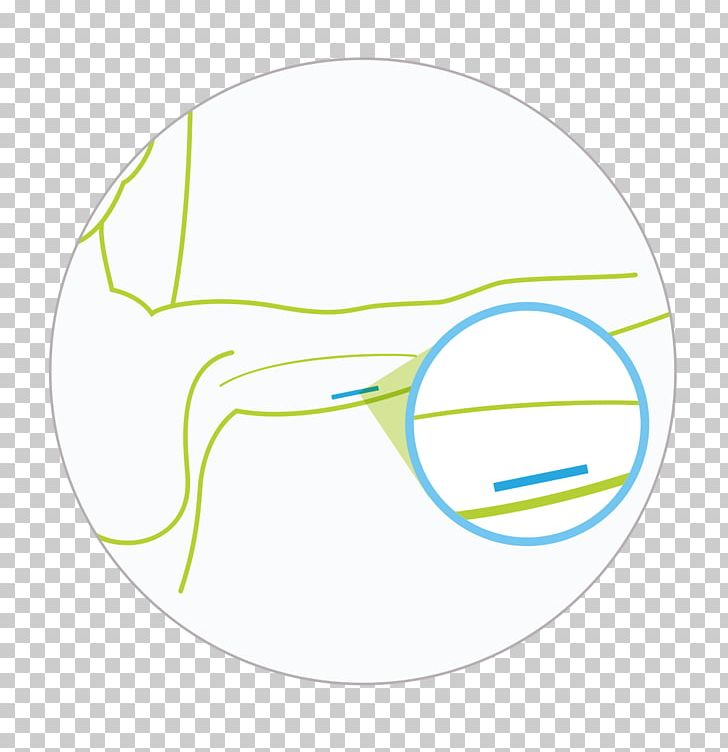 Glasses Goggles Line PNG, Clipart, Angle, Animal, Area, Circle, Contraceptive Patch Free PNG Download