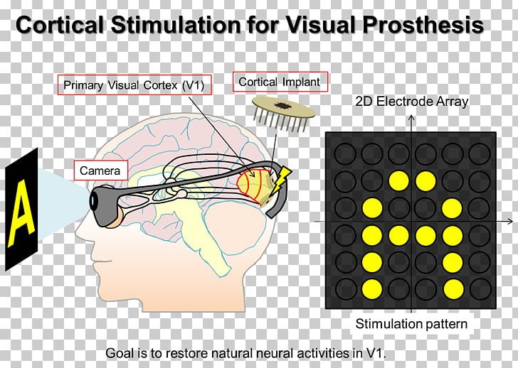 Visual Prosthesis Implant Microcoil Technology PNG, Clipart, Angle, Area, Cerebral Cortex, Communication, Diagram Free PNG Download