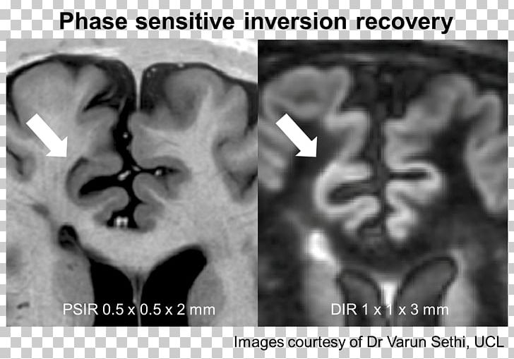 Nose Medical Imaging Human Behavior Medical Radiography Homo Sapiens PNG, Clipart, Behavior, Black And White, Chest, Ear, Face Free PNG Download