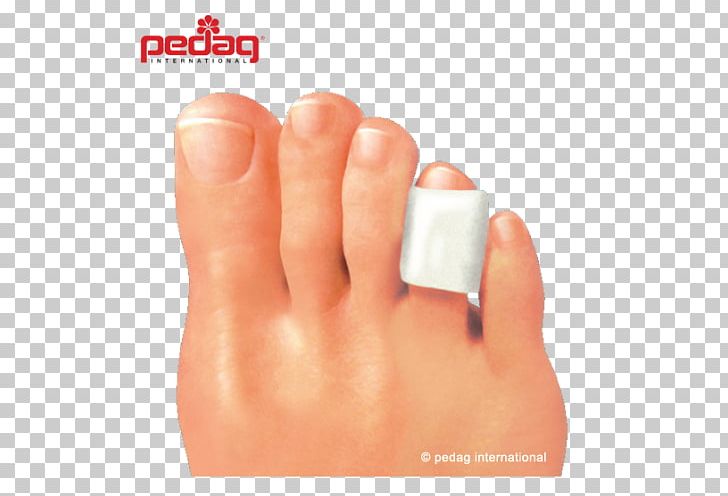 Corn Toe Foot Pain Wart PNG, Clipart, Ankle, Corn, Finger, Foot, Gel Free PNG Download
