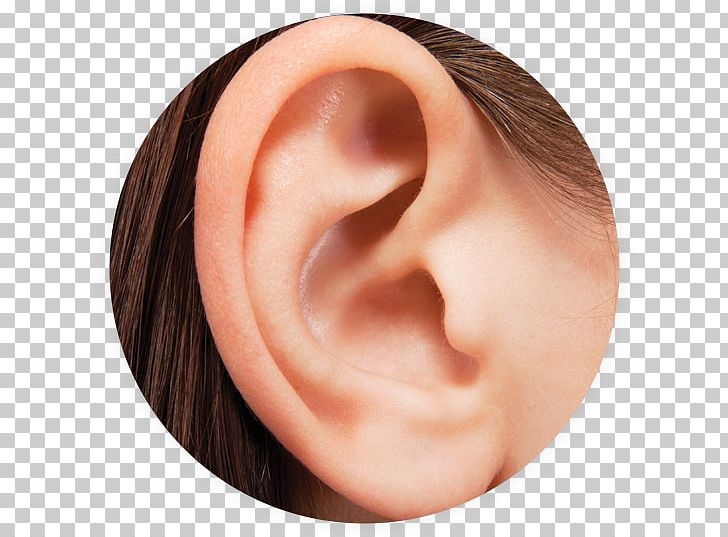 Earwax Otitis Ear Pain Hearing Loss PNG, Clipart, Cauliflower Ear, Cheek, Chin, Closeup, Ear Free PNG Download