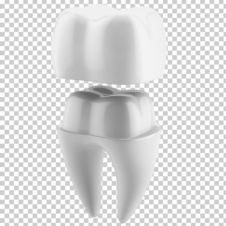 Crown CAD/CAM Dentistry Tooth PNG, Clipart, Bridge, Cadcam Dentistry, Crown, Dental, Dental Restoration Free PNG Download