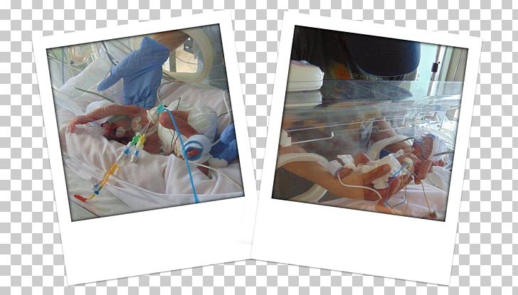 Queen Elizabeth University Hospital Neonatal Intensive Care Unit Infant Birth Plastic PNG, Clipart, Art, Birth, Glasgow, Incubator, Infant Free PNG Download