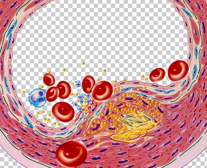 Low-density Lipoprotein Arteriosclerosis Platelet Illustration PNG, Clipart, Adi, Animation, Atheroma, Blood, Blood Lipids Free PNG Download