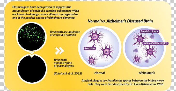 Ether Plasmalogen Alzheimer's Disease Dementia Phospholipid PNG, Clipart,  Free PNG Download