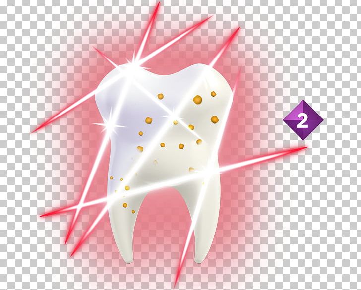 Tooth Decay Acid Toothpaste Dental Plaque PNG, Clipart, Acid, Bacteria, Colgate, Colgatepalmolive, Dental Plaque Free PNG Download