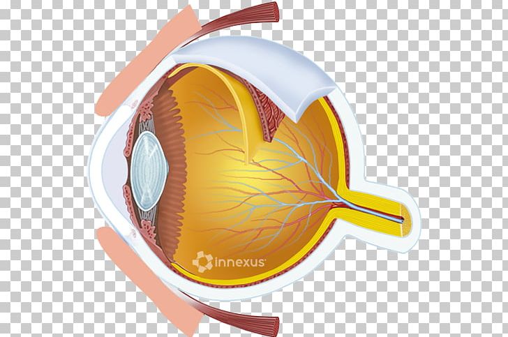 Glaucoma Human Eye Retina Eye Care Professional PNG, Clipart, Diabetes Mellitus, Diabetic, Eye, Eye Care, Eye Care Professional Free PNG Download
