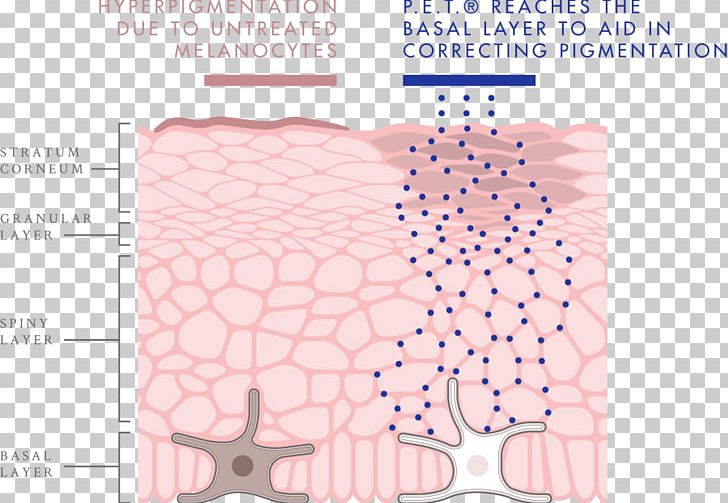 Melanocyte Melanin Skin Hyperpigmentation Tyrosinase PNG, Clipart, Angle, Area, Cause, Cell, Diagram Free PNG Download