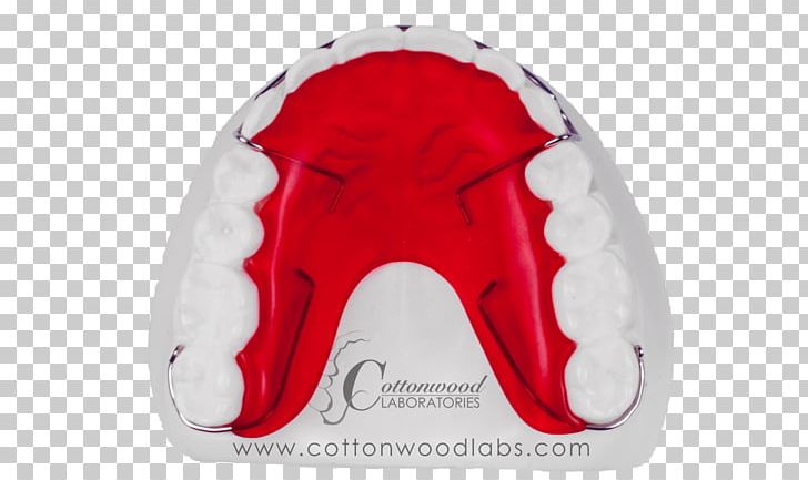 Laboratory Retainer Jaw Welding Tray PNG, Clipart, Cottonwood, Jaw, Laboratory, Organ, Others Free PNG Download