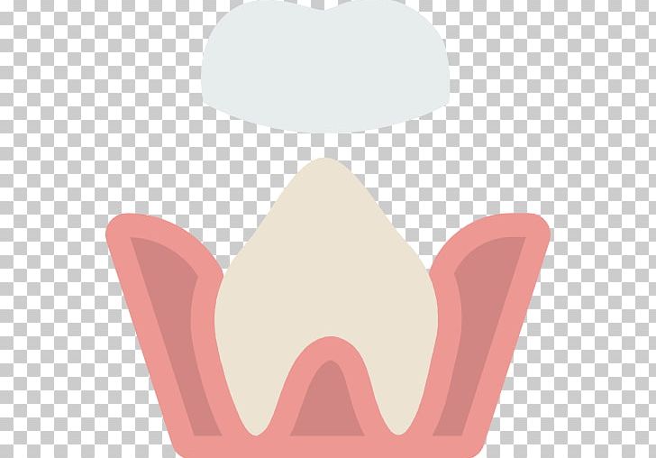 Tooth Dentistry Bridge Dental Implant PNG, Clipart, Angle, Bleeding On Probing, Bridge, Cosmetic Dentistry, Dental Free PNG Download