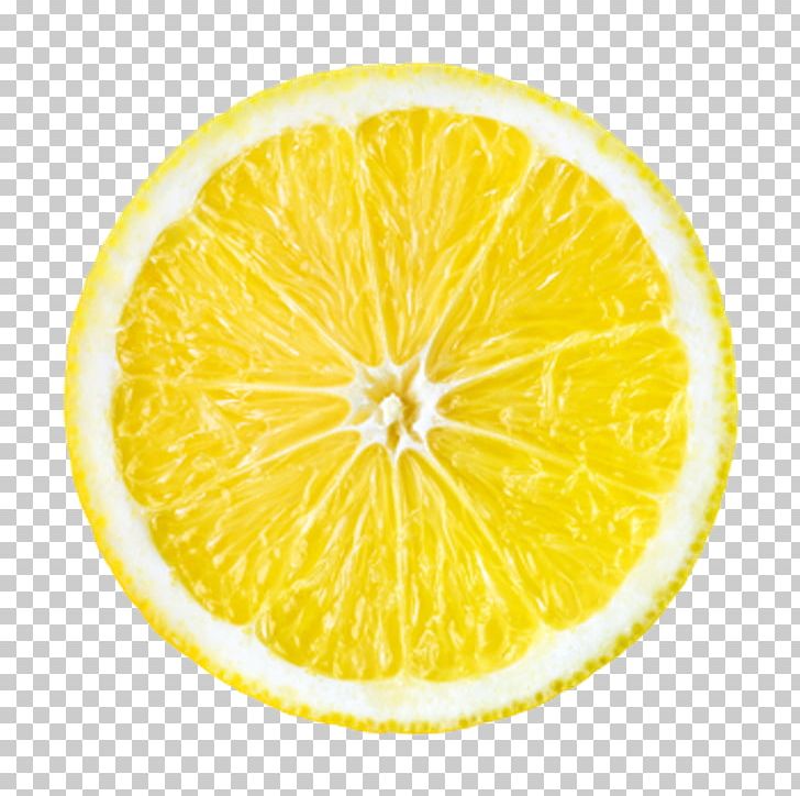 Lemon Juice Orange Citron Citrus × Sinensis PNG, Clipart, Circle, Citric Acid, Citron, Citrus, Citrus Sinensis Free PNG Download