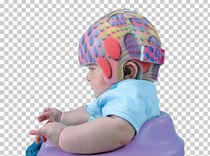 Prosthetics And Orthotics Helmet Prosthesis Physical Medicine And Rehabilitation PNG, Clipart, Back Brace, Cap, Cerebral Palsy, Child, Head Free PNG Download