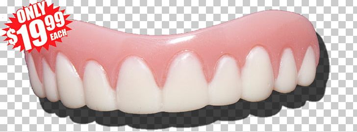 Human Tooth Dentures Veneer Wisdom Tooth PNG, Clipart, Canine Tooth, Cosmetic Dentistry, Deciduous Teeth, Dentist, Dentistry Free PNG Download