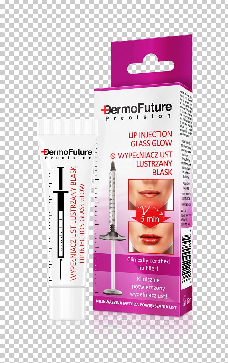 Lip Augmentation Lip Balm Hyaluronic Acid Injection PNG, Clipart, Acid, Allergy, Cosmetics, Cream, Face Free PNG Download