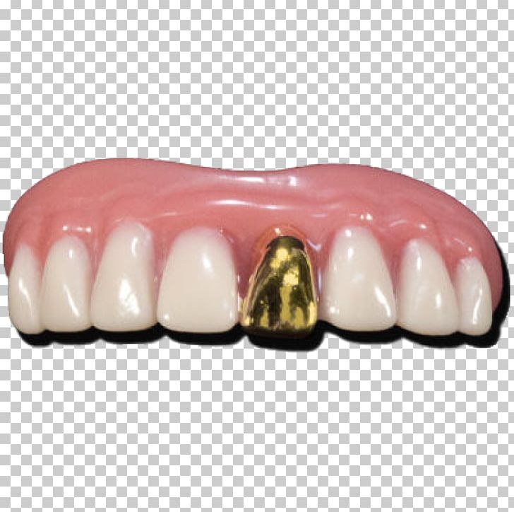 Human Tooth Gold Teeth Dentures PNG, Clipart, Bling, Bling Bling, Blingbling, Crown, Deciduous Teeth Free PNG Download