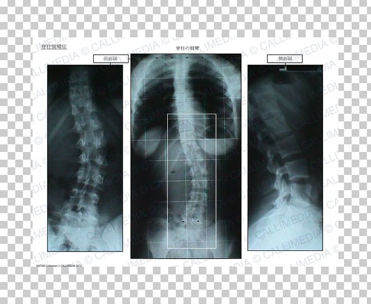X-ray Radiology Medical Imaging Medical Radiography Poster PNG, Clipart, Jaw, Magnetic Resonance Imaging, Medical, Medical Imaging, Medical Radiography Free PNG Download
