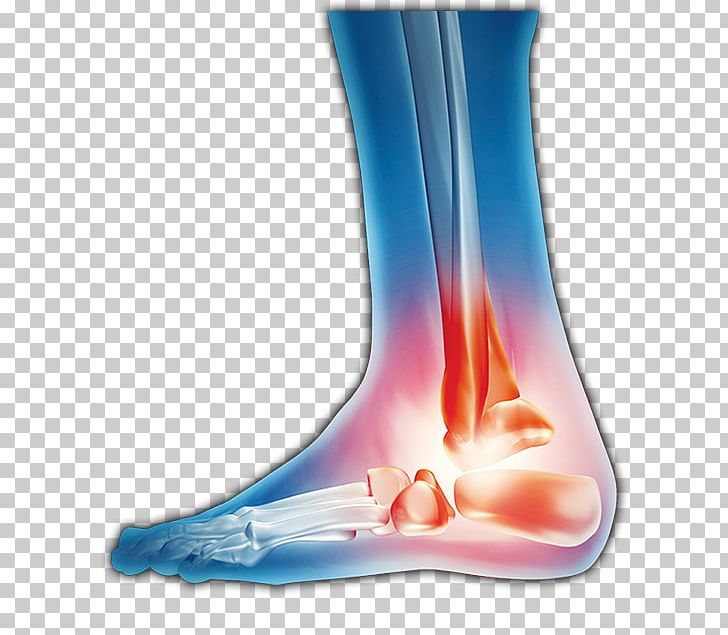 Brandon Private Occupational Therapy Clinic Foot Pedorthist PNG, Clipart, Ache, Barware, Brandon, Clinic, Compression Stockings Free PNG Download