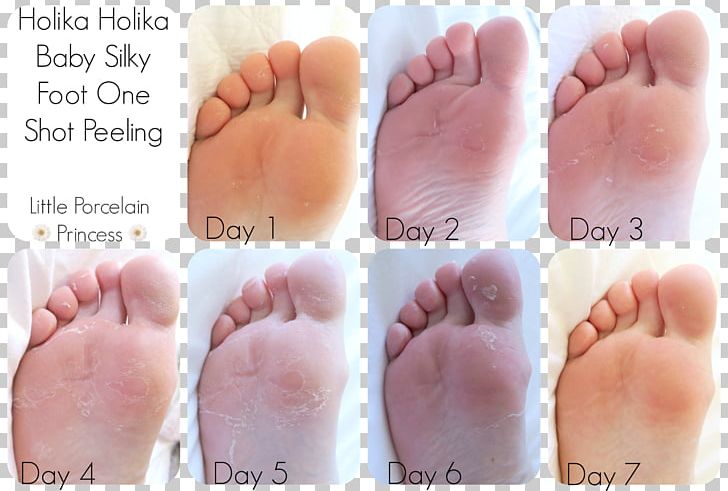 Nail Toe Holika Holika Baby Silky Foot One Shot Peeling Skin PNG, Clipart, Callus, Desquamation, Exfoliation, Finger, Foot Free PNG Download