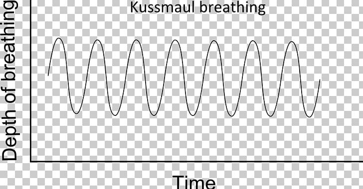 Kussmaul Breathing Kussmaul's Sign Respiration Respiratory System PNG, Clipart,  Free PNG Download