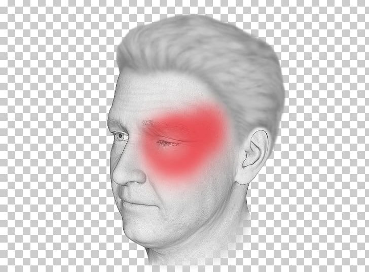 Cluster Headache Disease Nose Png Clipart Ache Analgesic Autonomic Nervous System Back Pain Cheek Free Png