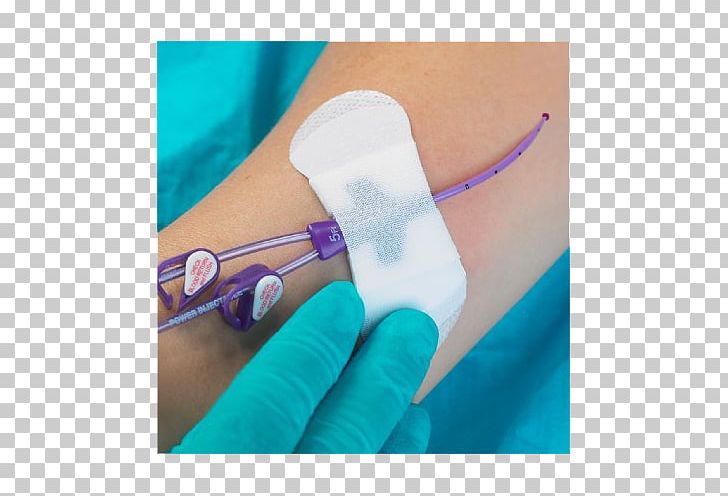 Peripherally Inserted Central Catheter C. R. Bard Central Venous Catheter Medicine PNG, Clipart, Arm, Catheter, Central Venous Catheter, Contamination, C R Bard Free PNG Download