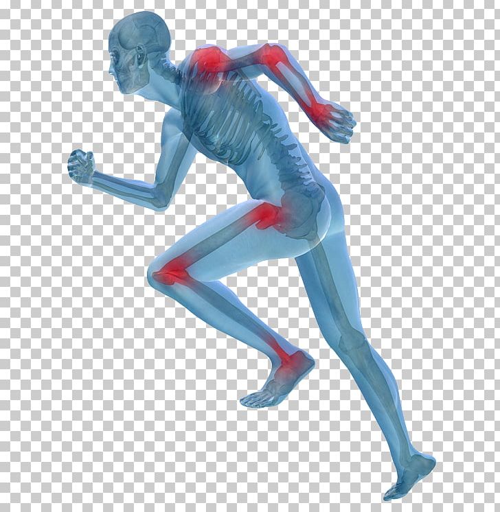 Pain In Spine Sports Medicine Therapy Pain Management Sports Injury PNG, Clipart, Acupuncture, Figurine, Health Care, Injury, Joint Free PNG Download