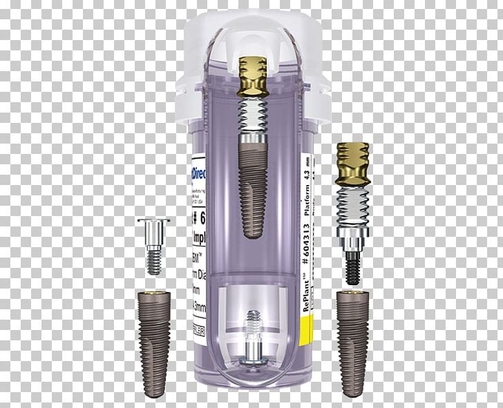 Dental Implant Surgery Dentistry Prosthodontics PNG, Clipart, Abutment, Crown, Dental Implant, Dentistry, Gums Free PNG Download