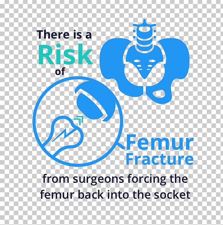 Femur Hip Fracture Femoral Head Bone Fracture Femoral Fracture PNG, Clipart, Area, Blue, Bone Fracture, Brand, Circle Free PNG Download