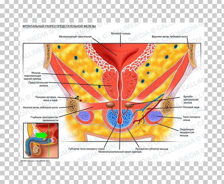 Prostate Urinary Bladder Pelvis Genitourinary System Anatomy PNG, Clipart, Abdomen, Anatomy, Art, Benign Prostatic Hyperplasia, Coronal Plane Free PNG Download