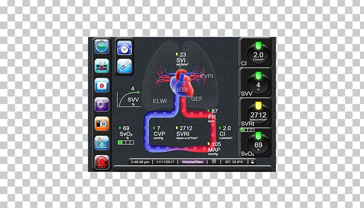 Display Device Cardiac Output Stroke Volume PNG, Clipart, Blog, Cardiac Output, Computer Hardware, Display Device, Edwards Lifesciences Free PNG Download