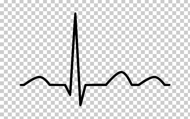 Electrocardiography Cardiology Heart Sinus Rhythm PNG, Clipart, Angle, Area, Black, Black And White, Cardiac Arrest Free PNG Download