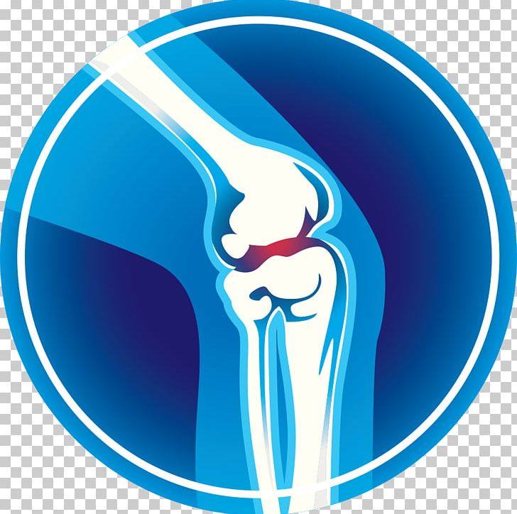 Knee Pain Joint Pain Computer Icons PNG, Clipart, Arthritis, Arthroplasty, Blue, Bone, Bone Fracture Free PNG Download