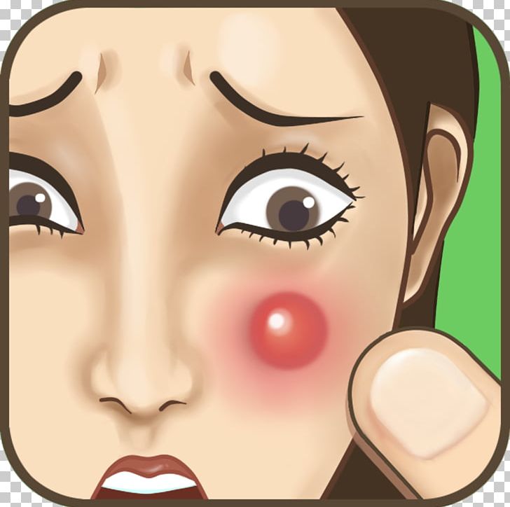 Pimple Acne Hairyfy My Face Tap Zombie PNG, Clipart, Acne, Apk, Blog, Brown Hair, Cheek Free PNG Download