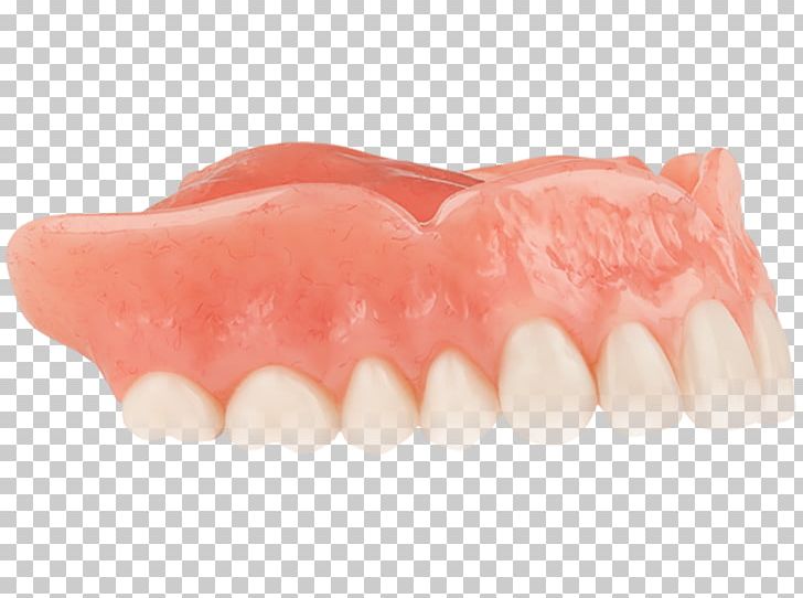 Tooth Dentures Dentistry YouTube PNG, Clipart, Aspen Dental, Dentistry, Dentures, Heat, Jaw Free PNG Download