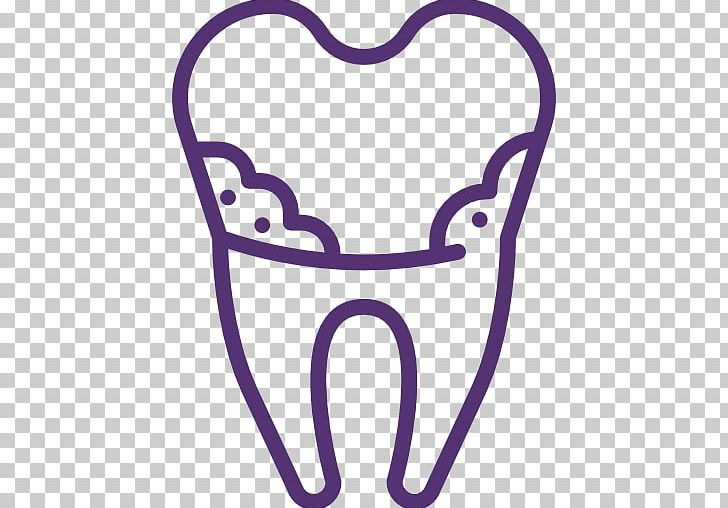 Cosmetic Dentistry Amati Dental Clinic Tooth PNG, Clipart, Body Jewelry, Clinic, Cosmetic Dentistry, Dental Implant, Dental Plaque Free PNG Download