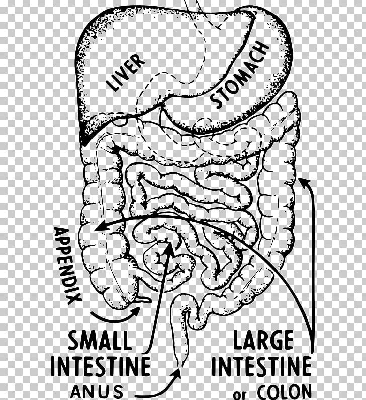 Appendix Appendicitis Large Intestine Symptom Abdominal Pain PNG, Clipart, Abdomen, Abdominal Pain, Angle, Appendicitis, Appendix Free PNG Download