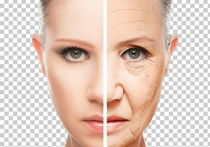 Wrinkle Skin Ageing Cosmetics Anti-aging Cream PNG, Clipart, Antiaging Cream, Beauty, Cheek, Chin, Closeup Free PNG Download
