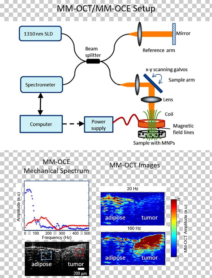 Elastography Medical Imaging Hyperthermie Magnétique Tissue Ultrasonography PNG, Clipart, Adipose Tissue, Area, Biophotonics, Brand, Diagram Free PNG Download