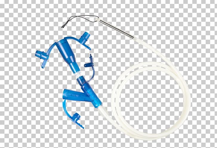 Feeding Tube Percutaneous Endoscopic Gastrostomy Jejunum Nasogastric Intubation PNG, Clipart, Angle, Blue, Catheter, C R Bard, Endoscopy Free PNG Download
