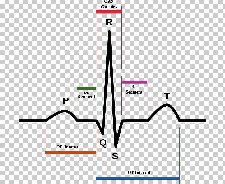 QT Interval Long QT Syndrome PR Interval T Wave QRS Complex PNG, Clipart, Angle, Area, Brand, Diagram, Electrocardiography Free PNG Download