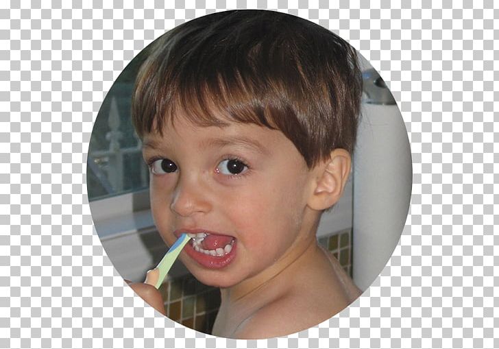 Cheek Tooth Decay Child Fluorine PNG, Clipart, Age, Boy, Brown Hair, Cheek, Chemical Element Free PNG Download
