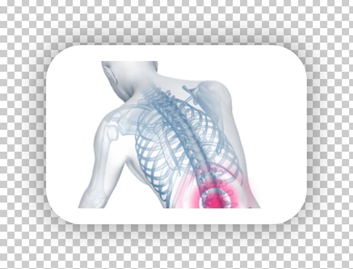 Nape Vertebral Column Anatomy Verspannung PNG, Clipart, Anatomy, Bone, Cervical Vertebrae, Finger, Hand Free PNG Download