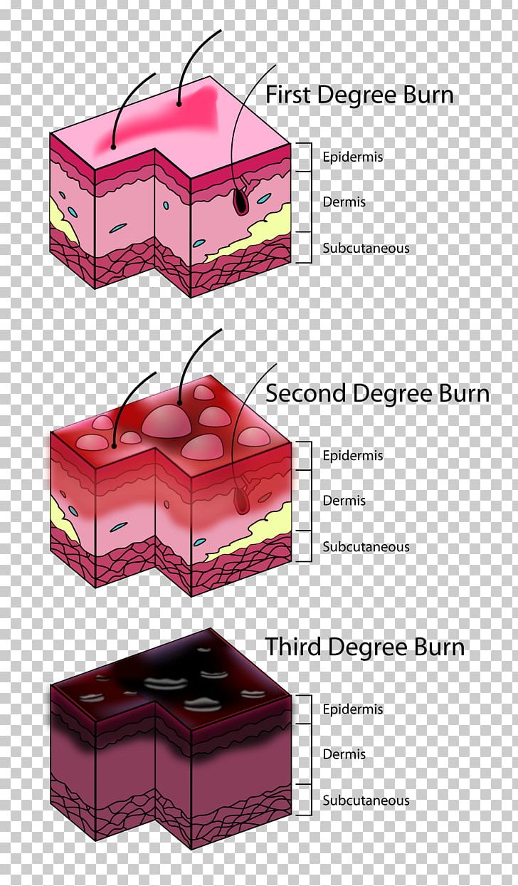 Burn Injury Third Degree First Aid Supplies Eerstegraads Brandwond PNG, Clipart, Academic Degree, Ache, Blister, Box, Bruise Free PNG Download