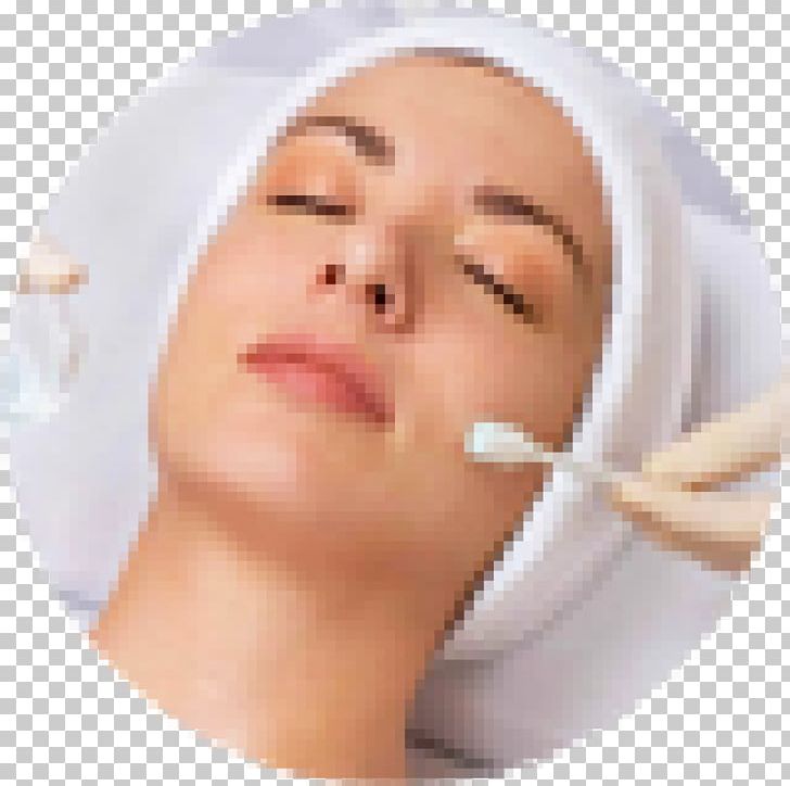 Chemical Peel Exfoliation Facial Glycolic Acid Skin PNG, Clipart, Acne, Beauty, Cheek, Chemical Peel, Chin Free PNG Download