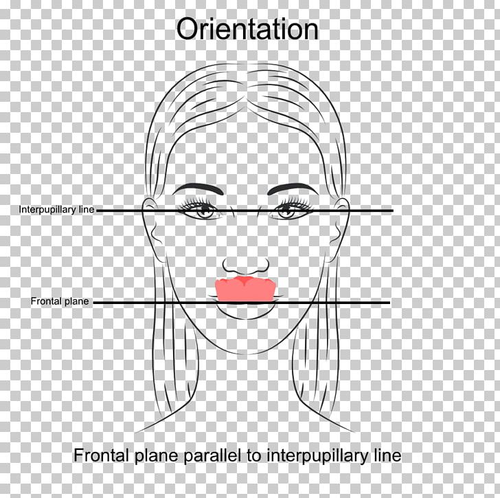 Dentistry A Clinical Guide To Occlusion Orthodontics Jaw PNG, Clipart, Angle, Cartoon, Dentistry, Dia, Drawing Free PNG Download