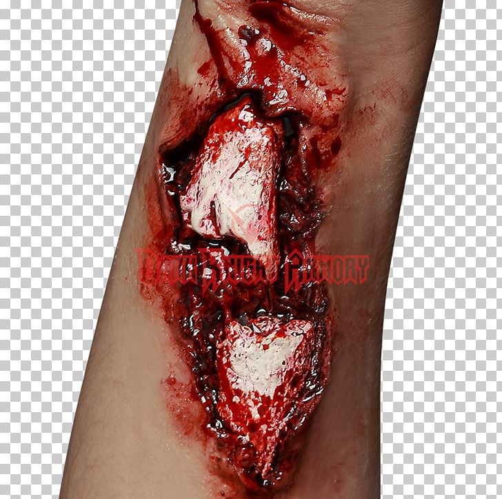 Wound Costume Carnival Make-up Scar PNG, Clipart, Arm, Blood, Broken Arm, Brown, Carnival Free PNG Download